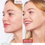 كريم سي سي لتصحيح احمرار البشرة كريم سي سي لتصحيح احمرار البشرة